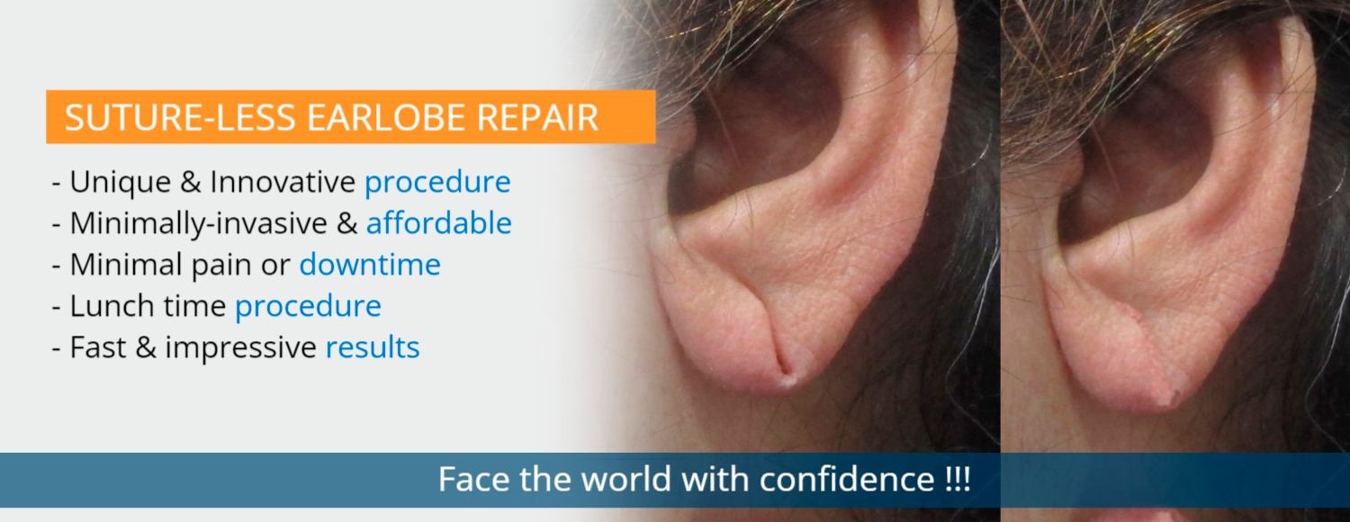 Earlobe Repair Surgery (Lobuloplasty): Repair Split or Torn Earlobes